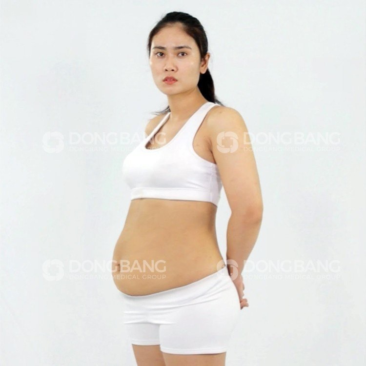 Chị Ngọc trước khi giảm béo với cân nặng 70kg