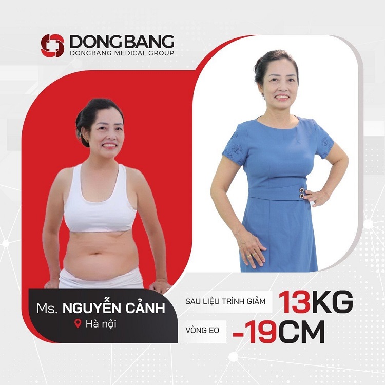 Chị Nguyễn Cảnh giảm được 13kg và 19cm vòng eo sau liệu trình giảm mỡ 