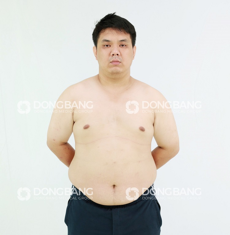Anh Phan với cân nặng 120kg được em gái dẫn đến Dongbang giảm cân
