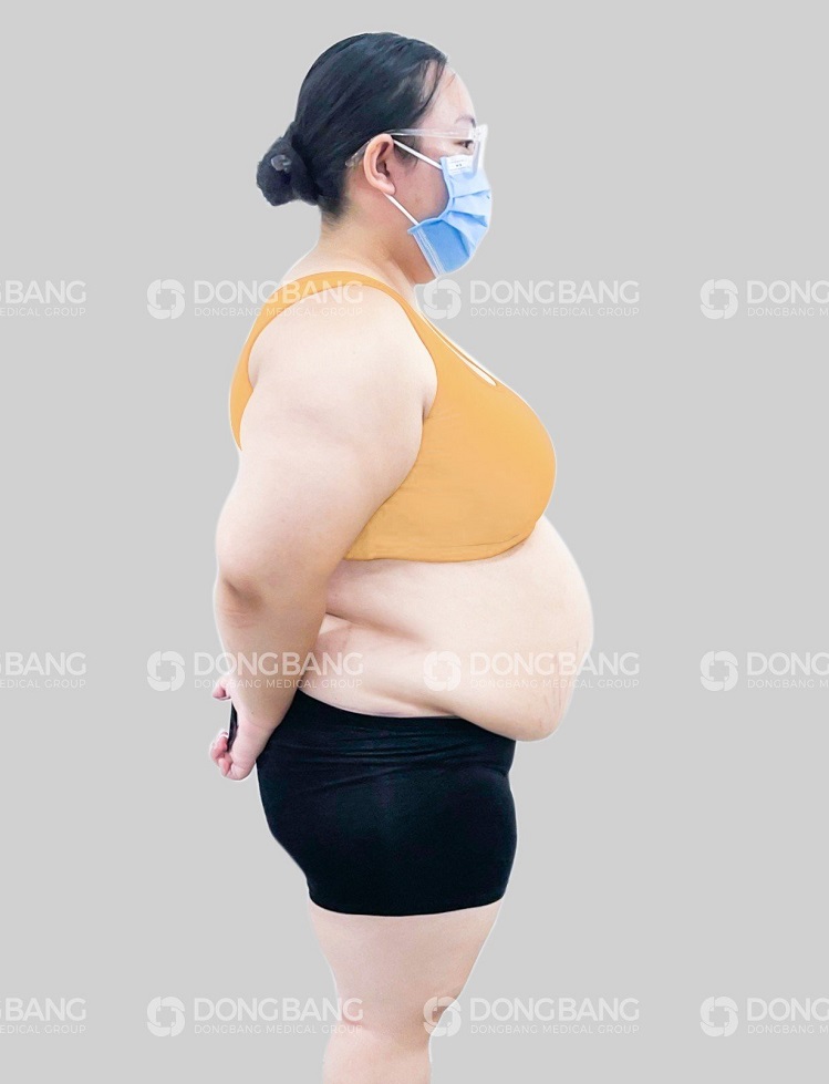 Chị Linh trước khi giảm béo 
