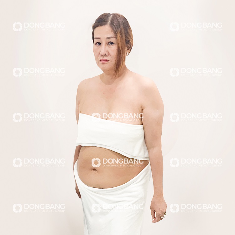 Chị Hương bị tăng cân do cách ăn uống không khoa học