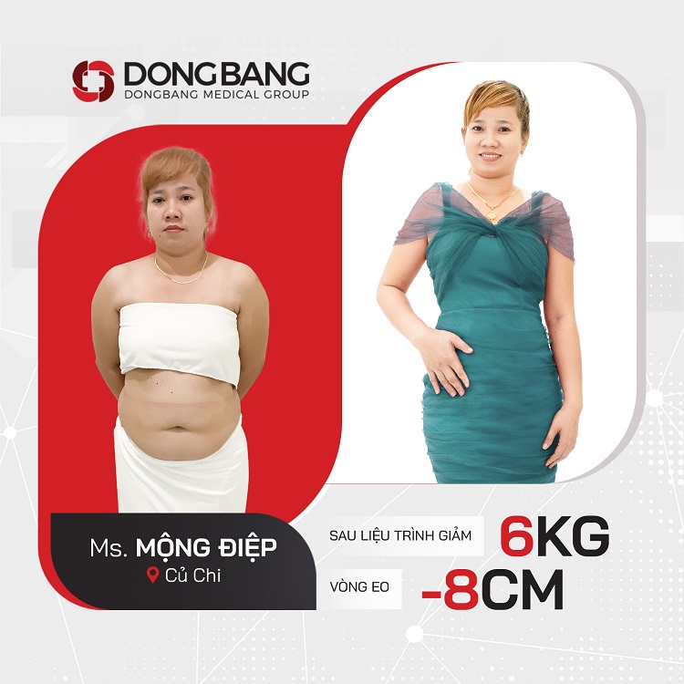 Vóc dáng thon gọn trước và sau giảm béo tại Dongbang