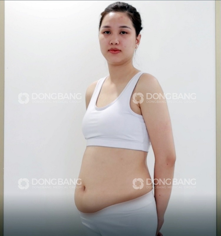 Chị Tú Anh trước khi giảm béo
