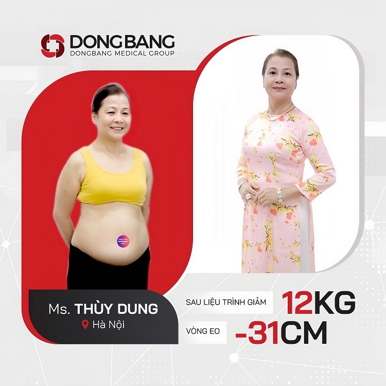Cô Dung trước và sau giảm cân, sức khỏe cải thiện