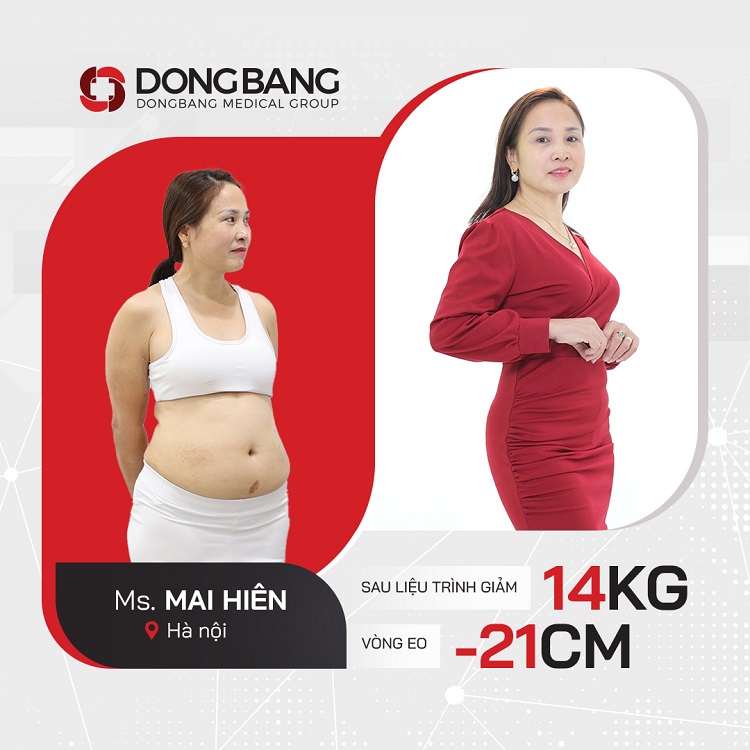 Chị Mai hiên giảm 14kg và 21cm vòng eo sau 2 tháng giảm cân
