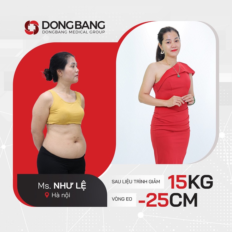Chị Như Lệ giảm được 15kg và 25cm vòng eo sau liệu trình giảm béo 