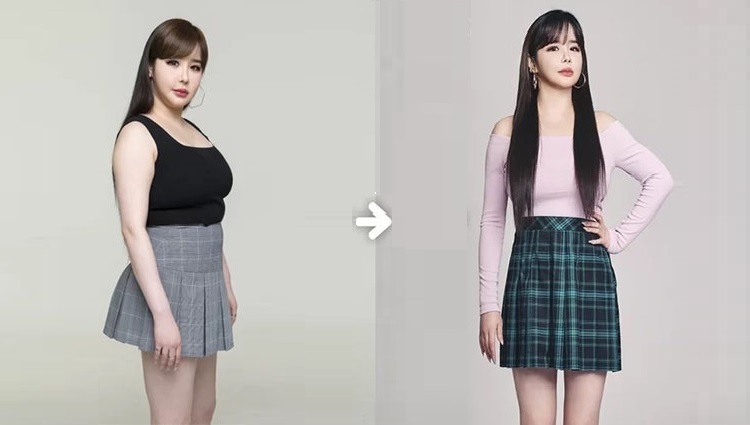 Park bom trước và sau khi giảm béo