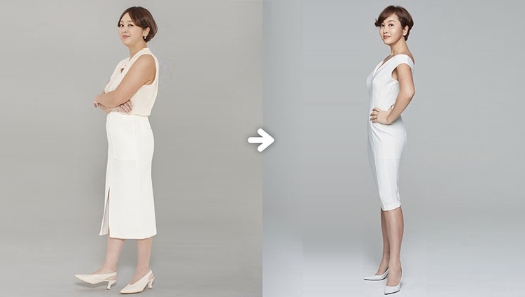 Lee-Seung-yeon trước avaf sau khi giảm cân