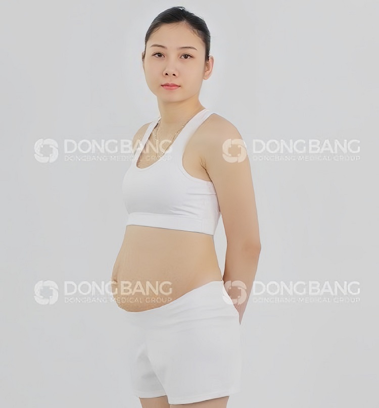 Chị Ngọc trước khi giảm béo với cân nặng 60kg