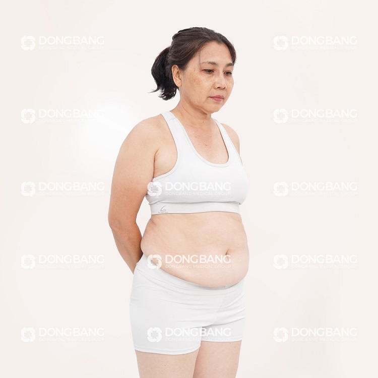 Cô Phượng đến Dongbang giảm béo
