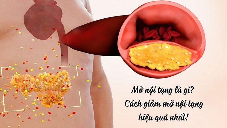 cách giảm mỡ nội tạng