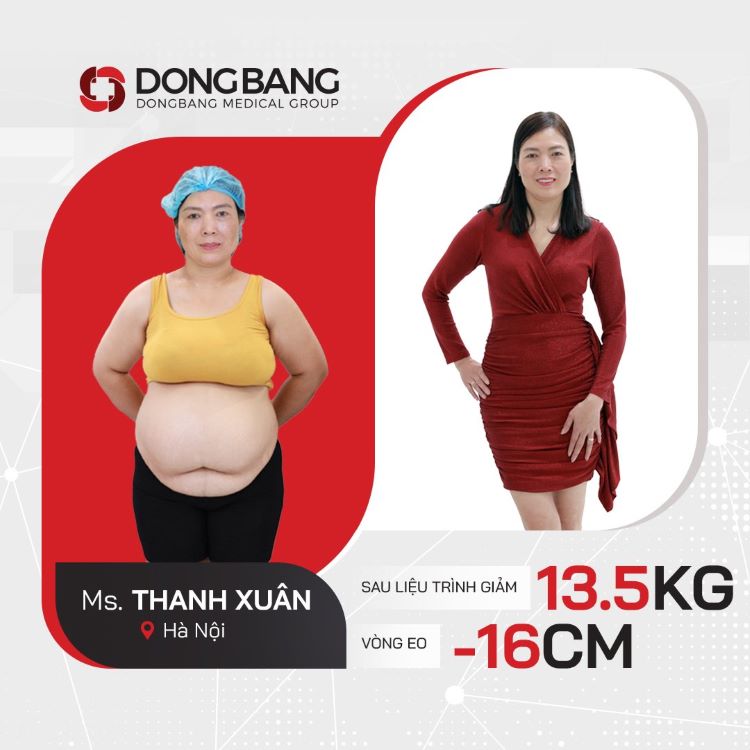 Cô Thanh Xuân trước và sau khi giảm béo 