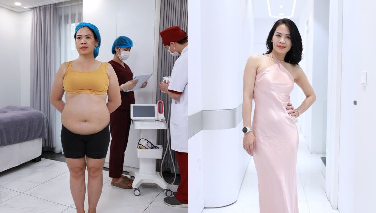 Hình ảnh chị Linh trước và sau khi giảm cân thành công 