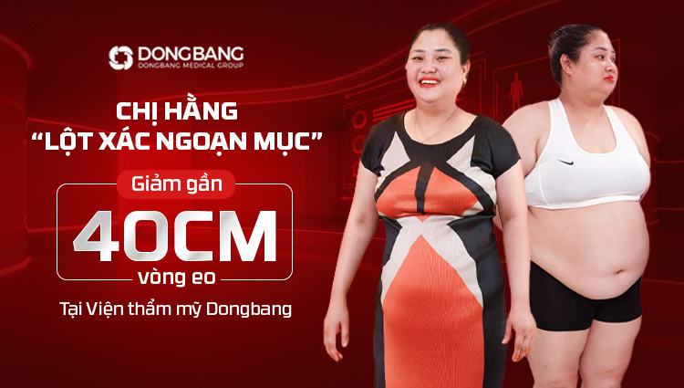 Chị Hằng “lột xác ngoạn mục” giảm gần 40cm vòng eo tại Viện thẩm mỹ Dongbang