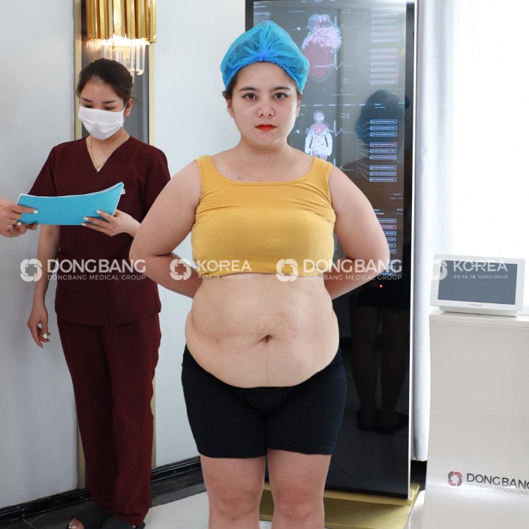 Hình ảnh chị Minh Ngọc trước khi đến Viện thẩm mỹ Dongbang