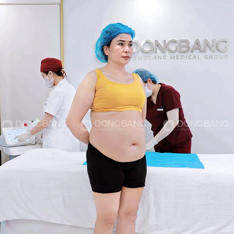 Chị Liên khi đến Viện thẩm mỹ Dongbang giảm béo 