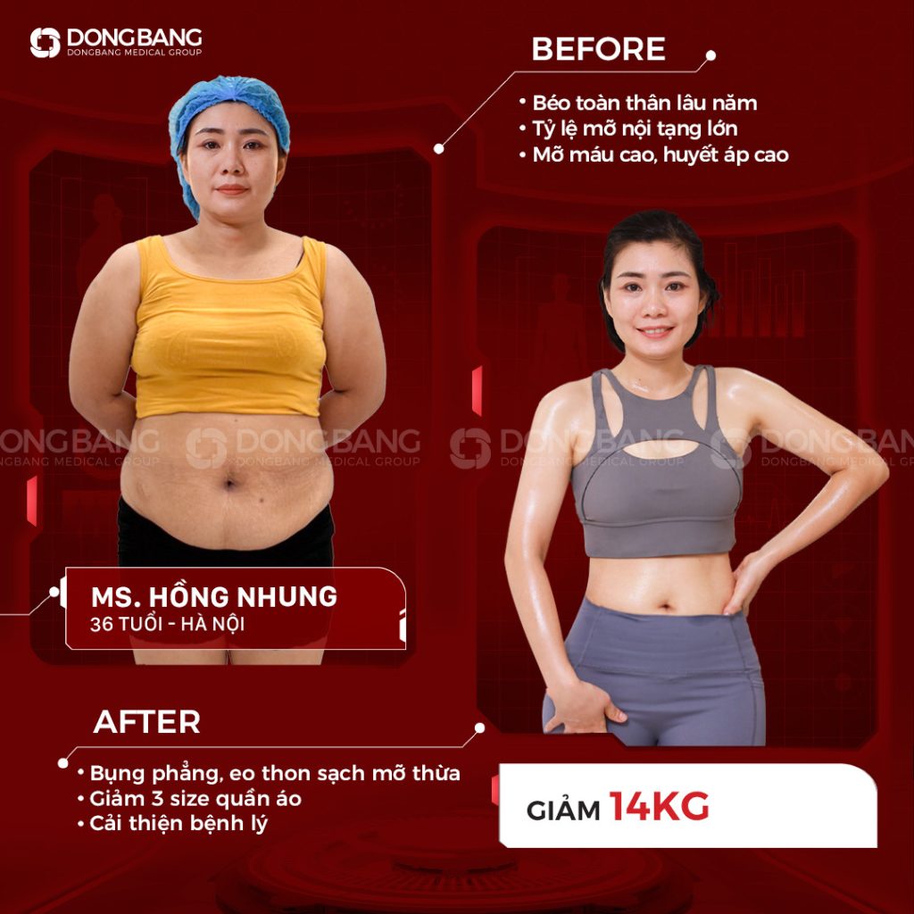 Hình ảnh chị Nhung trước sau khi giảm cân