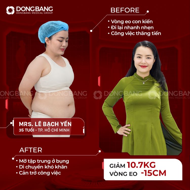 Chị Yến thực hiện giảm béo tại Viện thẩm mỹ Dongbang 