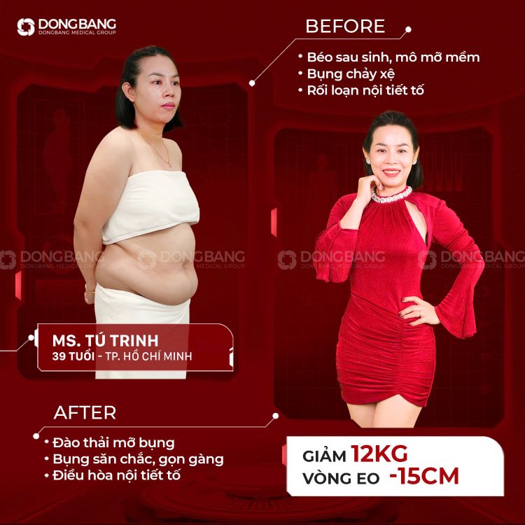 Chị Tú Trinh với vòng eo thon gọn sau khi giảm 12kg