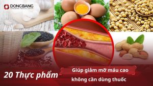 20 Thực phẩm giúp giảm mỡ máu cao không cần dùng thuốc