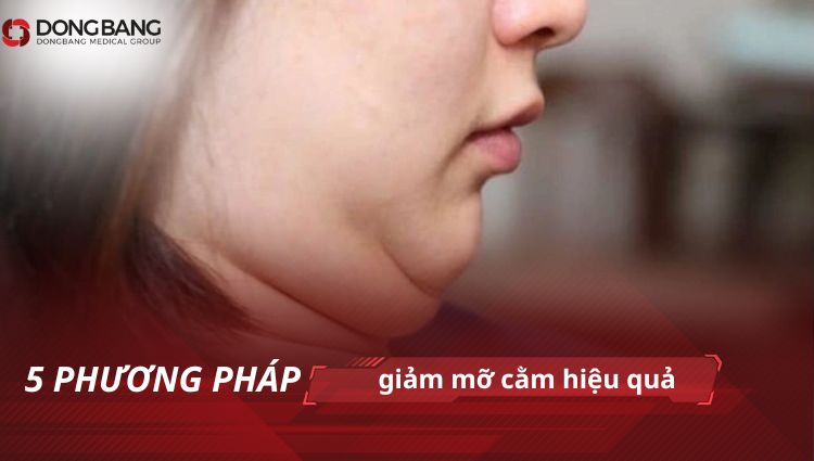 5 phương pháp giảm mỡ cằm hiệu quả