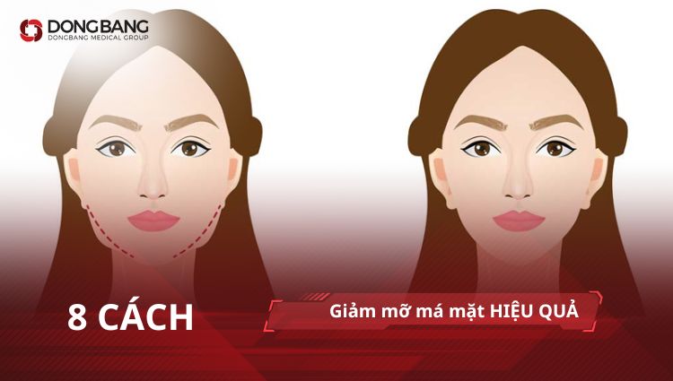 Chuyên gia gợi ý 8 cách giảm mỡ má mặt HIỆU QUẢ