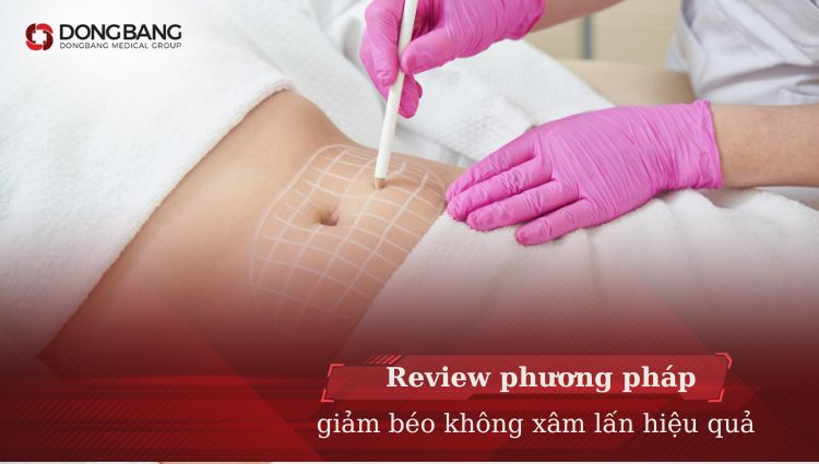 Review giảm béo không xâm lấn