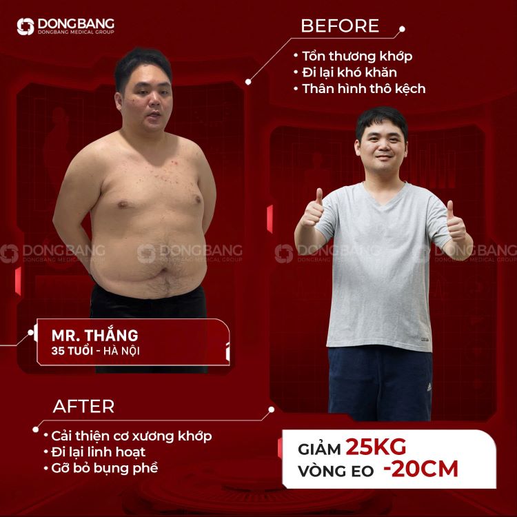 Anh Thắng giảm 25kg tại VTM Dongbang 