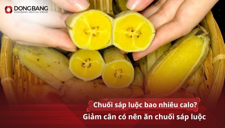 Chuối sáp luộc bao nhiêu calo? Giảm cân có nên ăn chuối sáp luộc