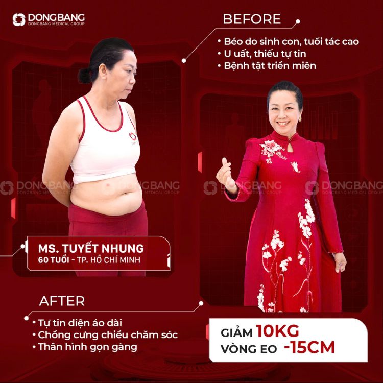 Cô Tuyết Nhung trước và sau khi lấy lại thân hình xinh đẹp